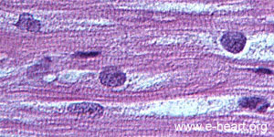 Myocytes H&E